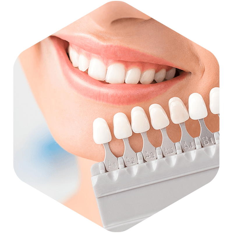 Patient choosing dental veneer